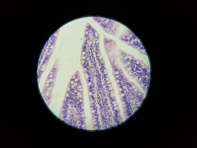 Simple Columnar Epithelium Slides - Simple Columnar Epithelium 03 100X